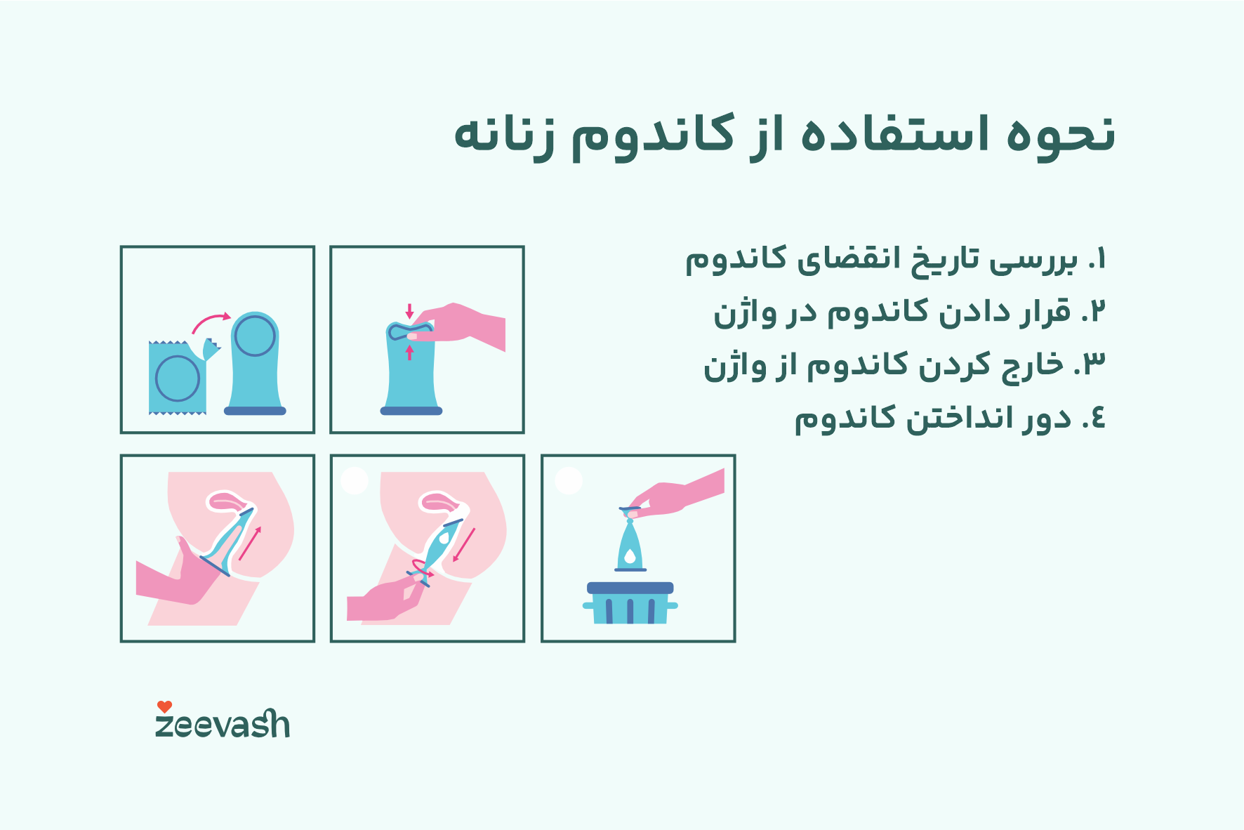 نحوه استفاده از کاندوم زنانه